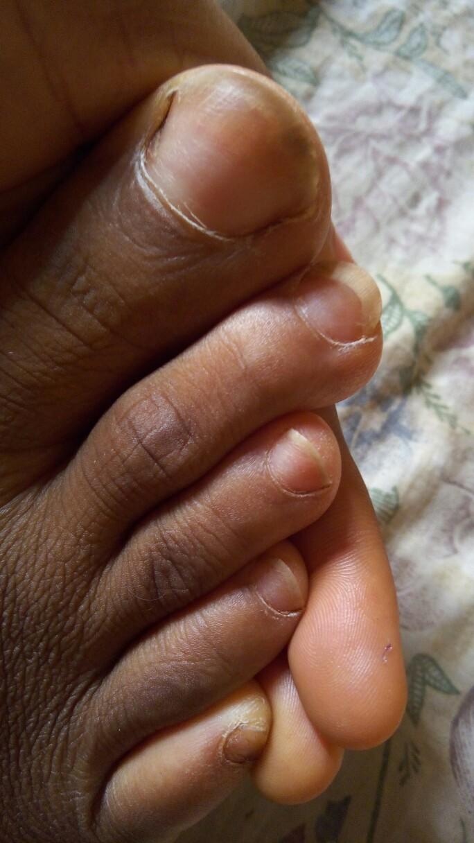 How often do you cut/trim your toenails?