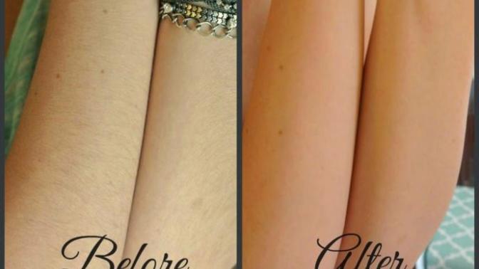 Shaving forearms?