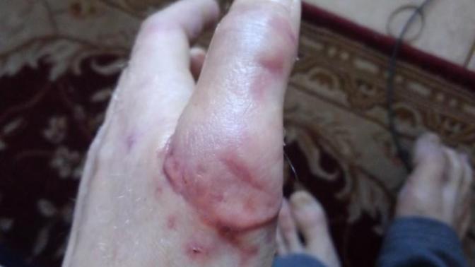 Nasty scars, attractive?