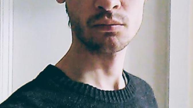 Do I have body dysmorphia disorder or am I really unattractive physically?
