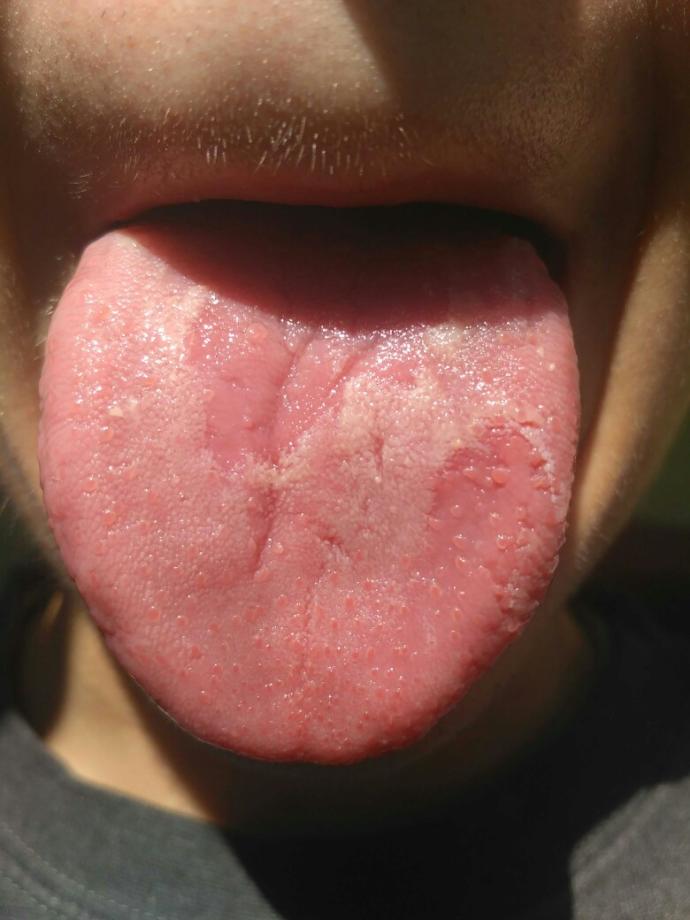 Why is my tongue so weird??