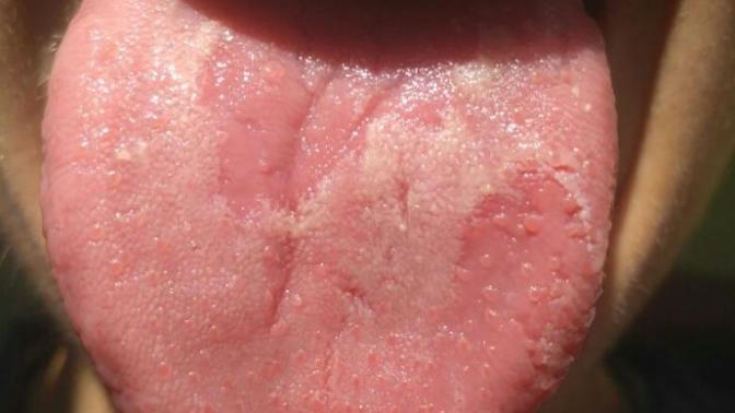 Why is my tongue so weird?