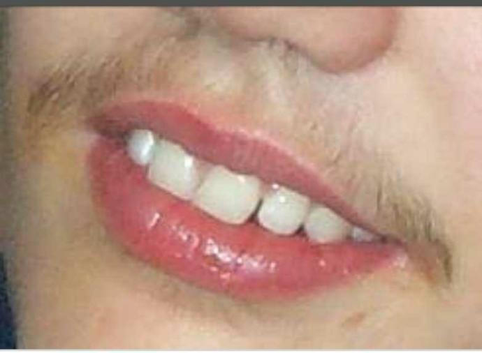 Guys , At What Age Did You First Shave Your 'Teenstache' ??