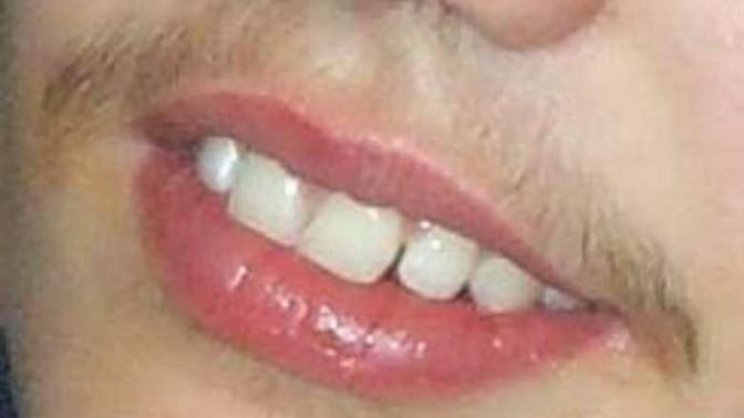 Guys , At What Age Did You First Shave Your 'Teenstache' ?
