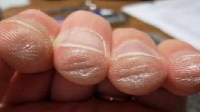 For those of you who play the guitar how do I make my fingers stronger? And what can I do to avoid getting split fingertips?