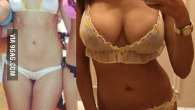 Opinions on breast augmentations? Are you for or against them?