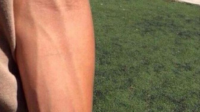Forearm veins are so attractive?