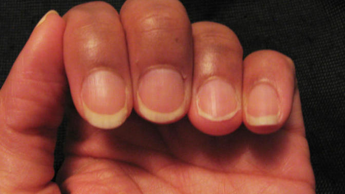 Are unattractive nails a turn off for guys?
