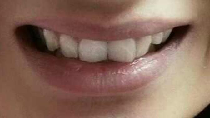 Do my teeth make my smile look bad?