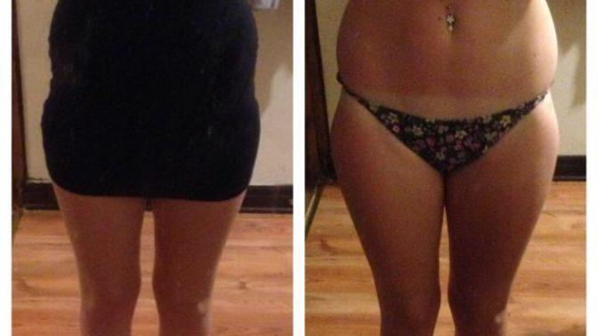 Are violin hips or hip dips ugly?