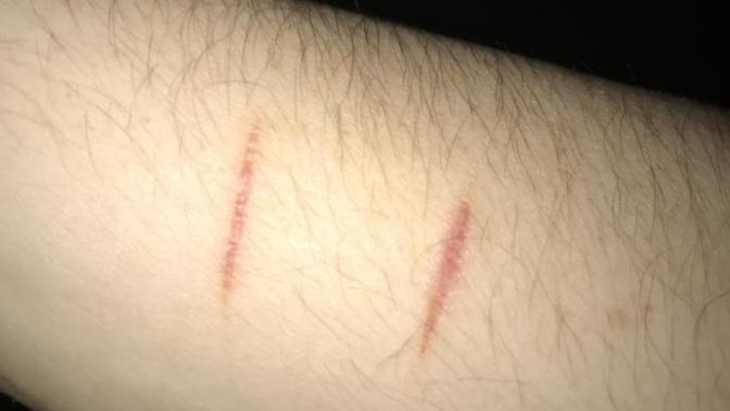 Are these deep cuts?