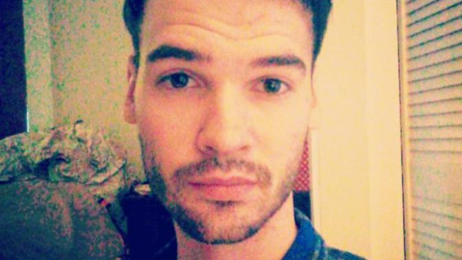 Girls, Is my thinning hair really obvious and weird looking?