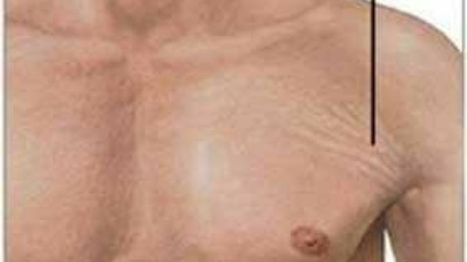 Am I the only finds who finds stretch marks hot?