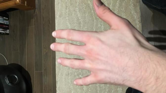 My hand really hurts (possibly from curling) and I have another game tomorrow! What to do?