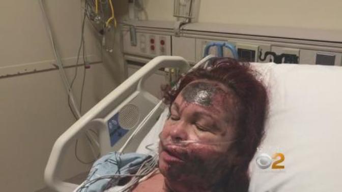 What do you think of this woman who falsely accused a black woman of throwing acid in her face?