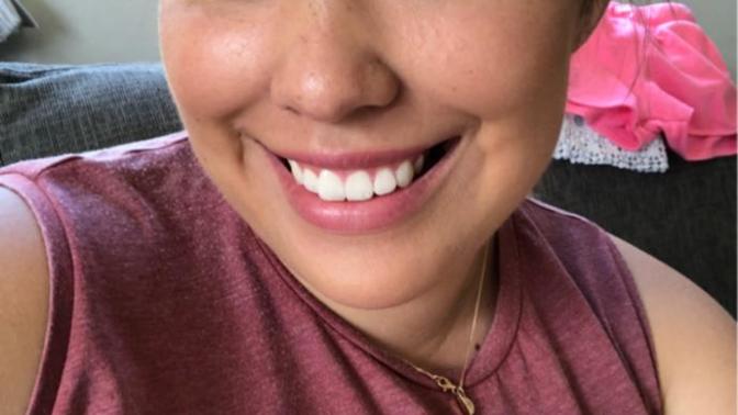 Is my top lip too thin and my nose too big?