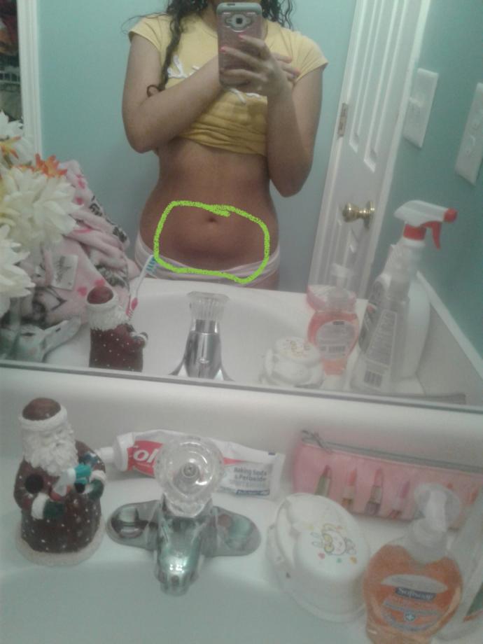 If a woman has a belly pouch like the one circled is it unattractive or attractive?