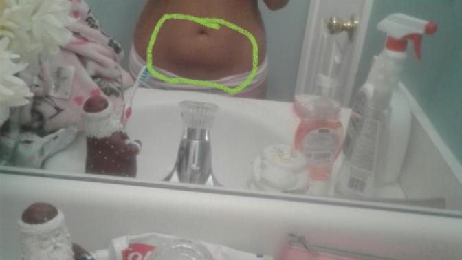 If a woman has a belly pouch like the one circled is it unattractive or attractive?