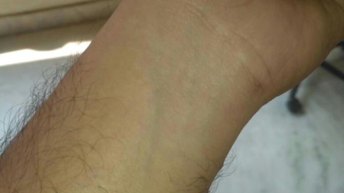 Guys is it green or blue veins on my hands?