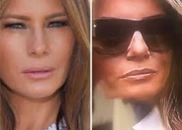 Is melania trump a transgender?