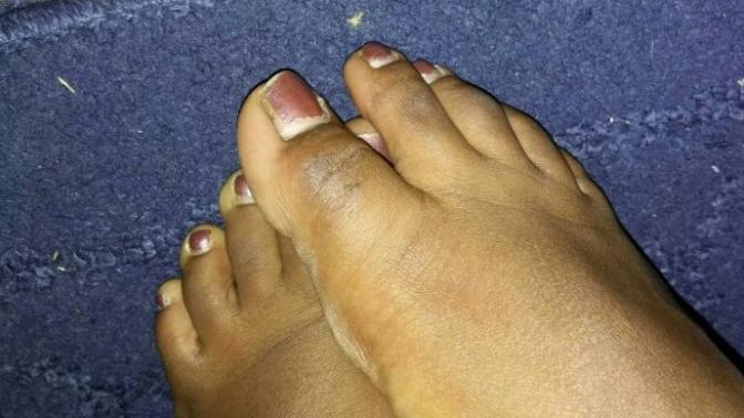Is it bad to always paint my toe nails?
