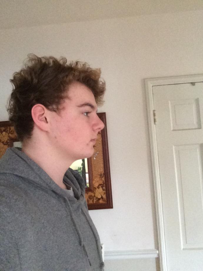 Does profile view matter?