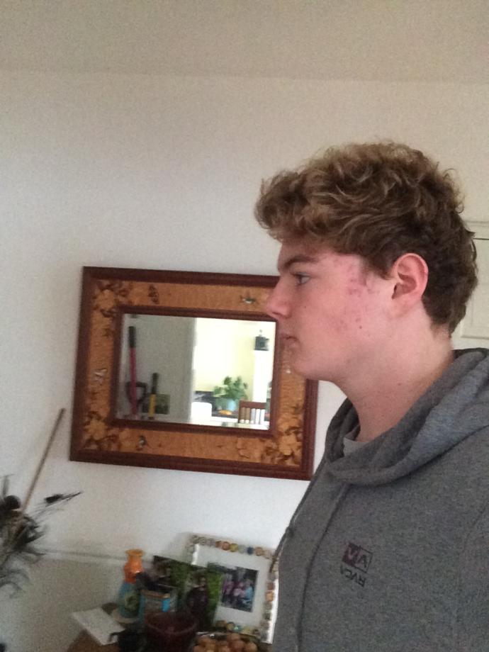 Does profile view matter?