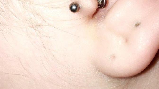 Bump in piercing?