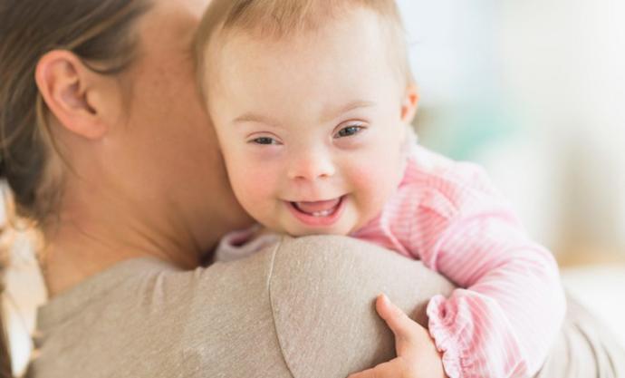 If you found out you were having a baby with Downs Syndrome, would you get an abortion? Why or why not?