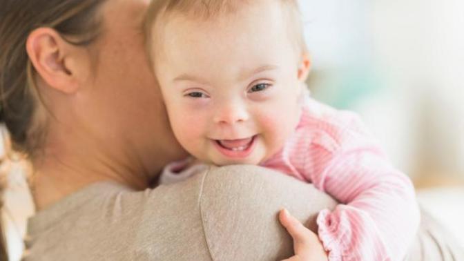 If you found out you were having a baby with Downs Syndrome, would you get an abortion? Why or why not?