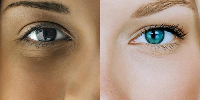 Why do whites have more diversity in hair and eye colors?
