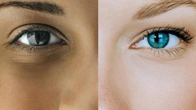 Why do whites have more diversity in hair and eye colors?