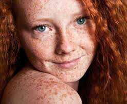 Redheads are beautiful??