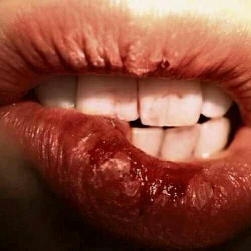 Are dry lips a deal breaker in dating?