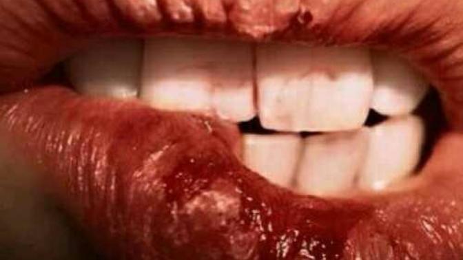 Are dry lips a deal breaker in dating?