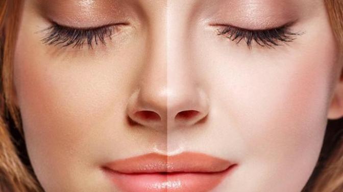Fair skin vs dark skin?