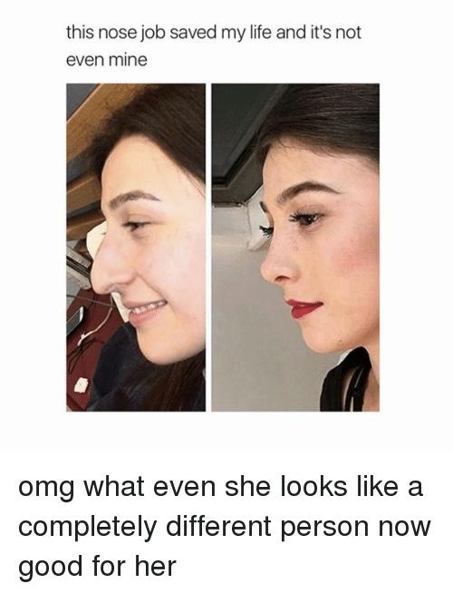 Would you judge a girl for getting a nose job?