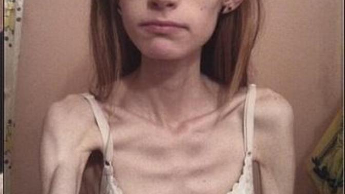 Does my sister really look weak? How do I convince my sister to gain weight?