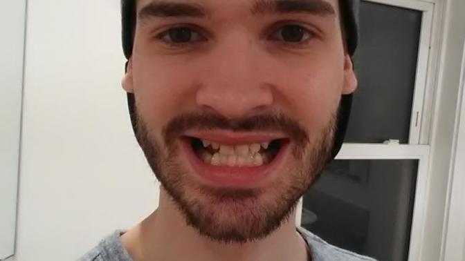 Girls, Are my teeth a deal breaker?
