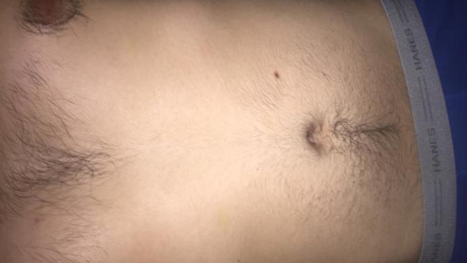 Should I shave my nipple and or chest hair?