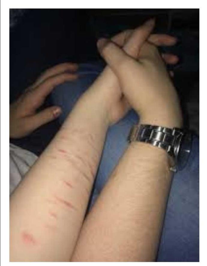 Would/could you date someone (male & female) with self harm scars?