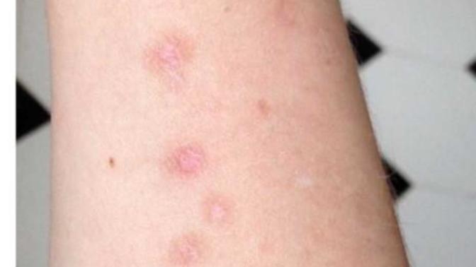 Would/could you date someone (male & female) with self harm scars?