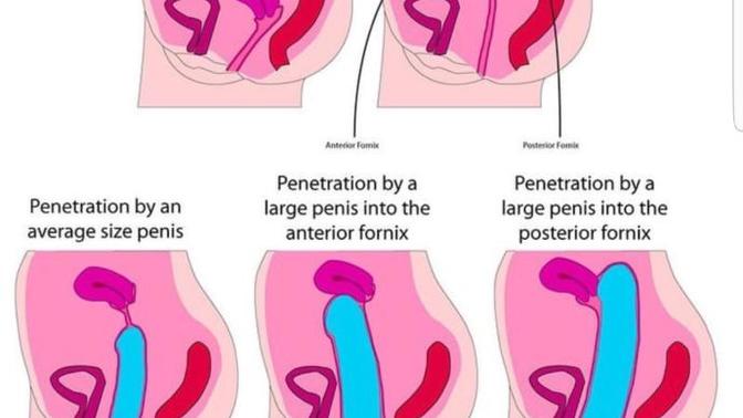 Do you agree with this picture?
