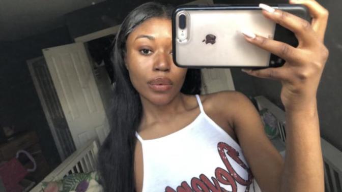 Is an Asymmetrical face something you are born with?