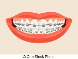 Girls, Do you find a tooth gap attractive?