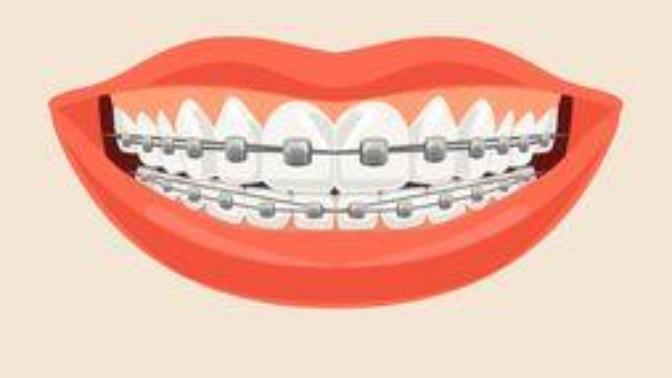 Girls, Do you find a tooth gap attractive?