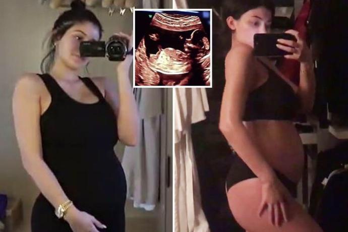 How Do you guys feel on Kylie Jenner being pregnant?