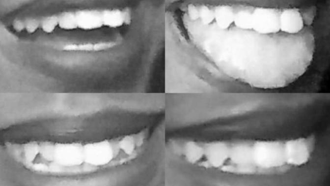 Are the these teeth/lips a deal breaker?