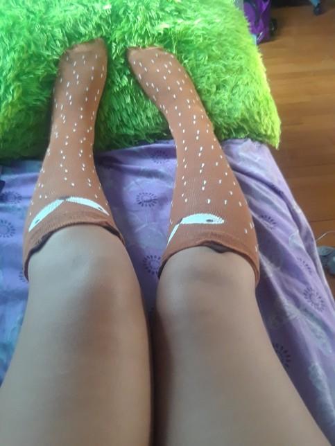 Which sock looks more cute??