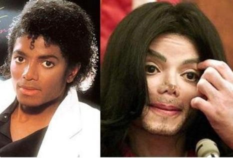 Is Michael Jackson considered black or white(after vitiligo)?
